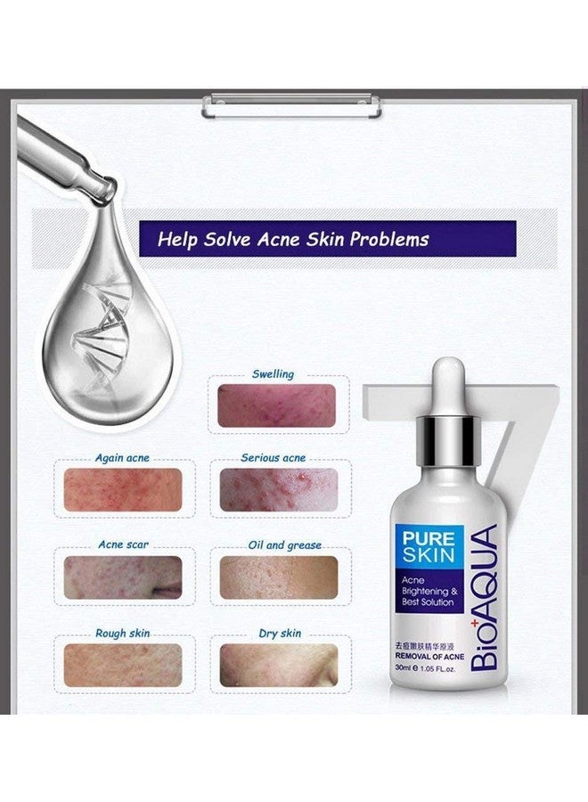 بيو أكوا 4In1 علاج حب الشباب وإزالة الندوب والبقع والبثور وكريم الزيت وأقنعة الوجه وعلامات العيب وزيت الترطيب 100 جرام + 30 جرام + 30 مللي + 4 قطعة X30G - Image 4