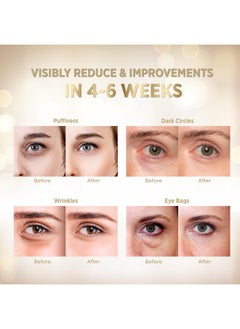 VELAMO ADVANCED Under Eye Patches 24K Gold Under Eye Mask For Puffy Retinol Patchology Eye Patches For Wrinkles And Dark Circles Puffiness Collagen Under Eye Bags Treatment For Women Men 60 Pcs  - Image 5