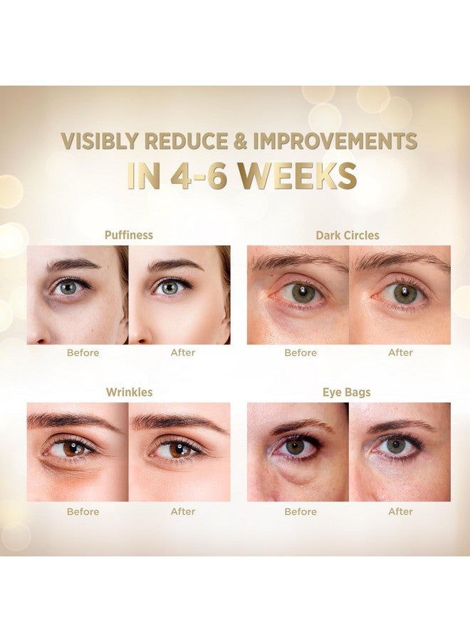 VELAMO ADVANCED Under Eye Patches 24K Gold Under Eye Mask For Puffy Retinol Patchology Eye Patches For Wrinkles And Dark Circles Puffiness Collagen Under Eye Bags Treatment For Women Men 60 Pcs - Image 5