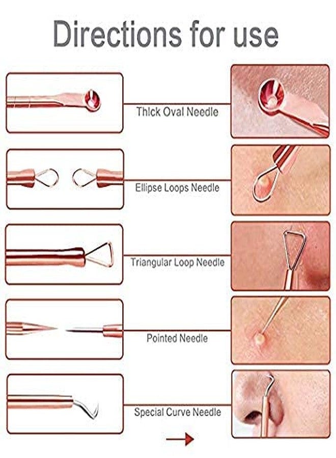 Beauzy Blackhead Pimple Golden Remover Tools for Professional Tweezers Kit for Remove Acne Comedone Extractor, Black Heads Removing on Face Removal - Image 3