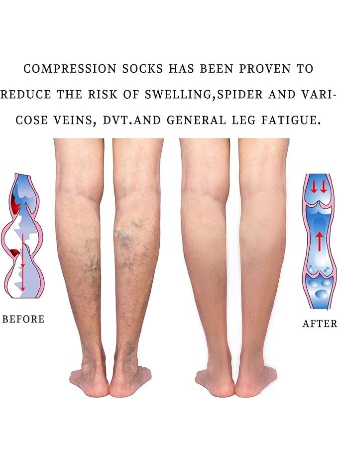Medical Compression Socks Open Toe - Knee High Support for Varicose Veins, Swollen Legs & Travel - Practical Daily Use - Image 4
