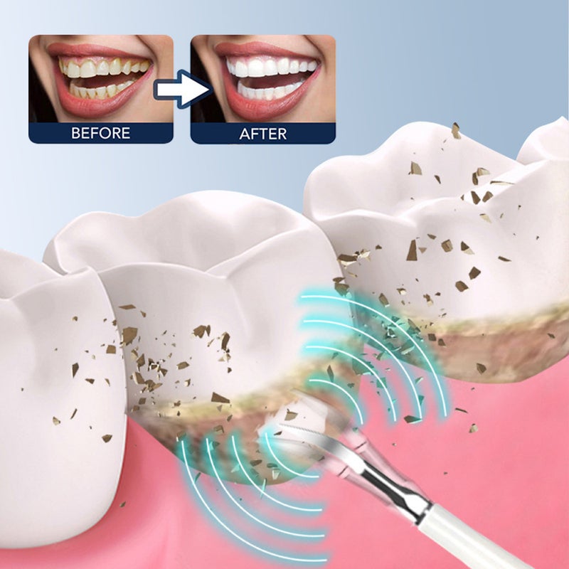 Products Electric Tooth Cleaner Six-In-One Electric Toothbrush Suit Portable Tooth Stone Removal Tooth Washing And Tooth Beauty Instrument - Image 4
