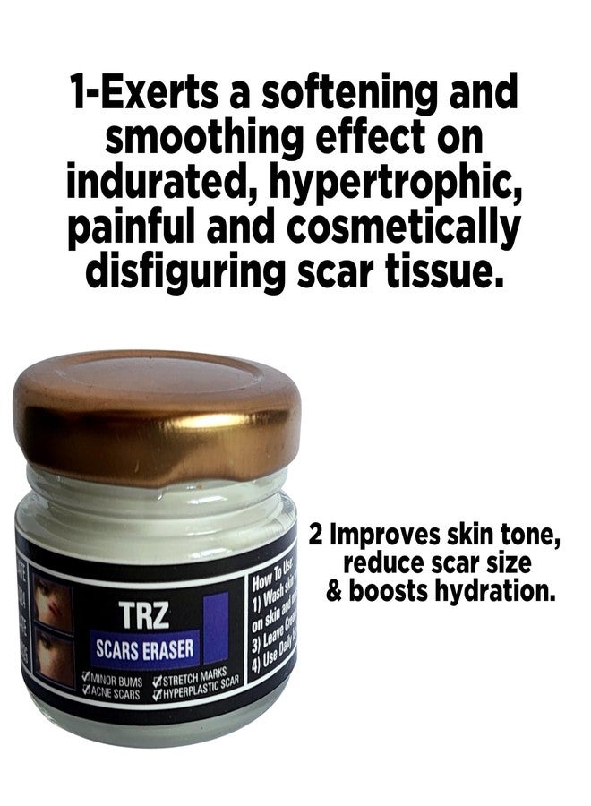 TRZ Scar remover cream Skin Care Stretch marks Scars remover for old scars Burn Scar Remover for Body And Face Scar Gel Acne Scar Treatment Skin Care cream - Image 3