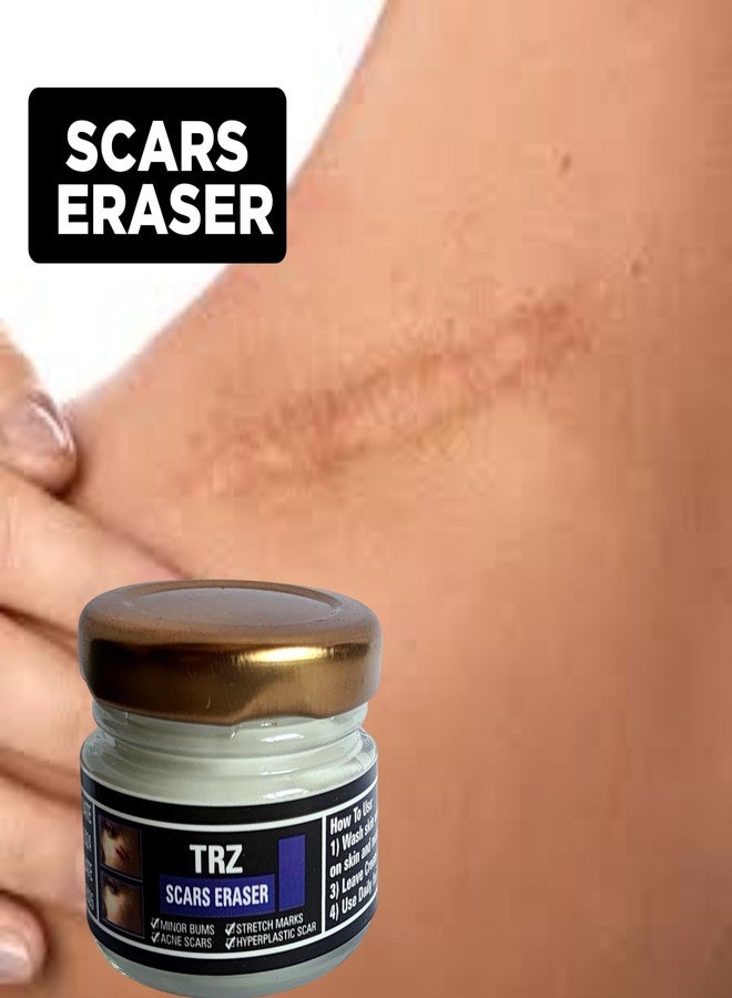 TRZ Scar remover cream Skin Care Stretch marks Scars remover for old scars Burn Scar Remover for Body And Face Scar Gel Acne Scar Treatment Skin Care cream - Image 2