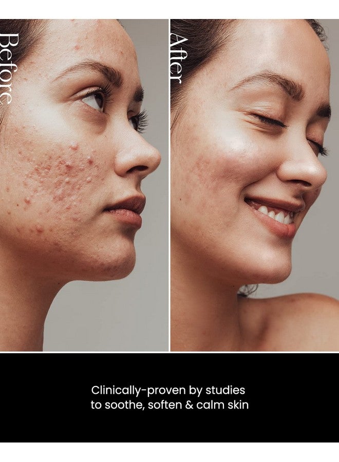 SON&PARK Beauty Water 340ml (11.49 fl. oz) | Multi-Purpose Toner for Oil Control Hydrating Exfoliating Skincare Daily Cleansing Booster with Rose Water Witch Hazel Lavender Oil - Image 2