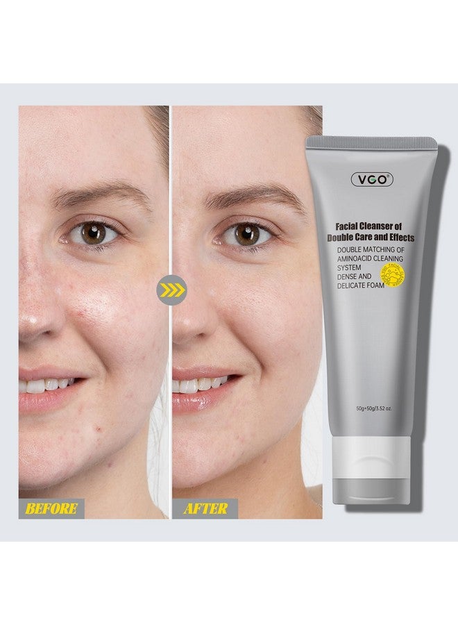 VGO VGO Facial Cleanser, Daily Face Wash of Double Care and Effects, Cleansing Mud Mask & Amino Acid Cleansing Double Tube in 1 Gentle Face Cleanser, 3.52 Oz  - Image 5