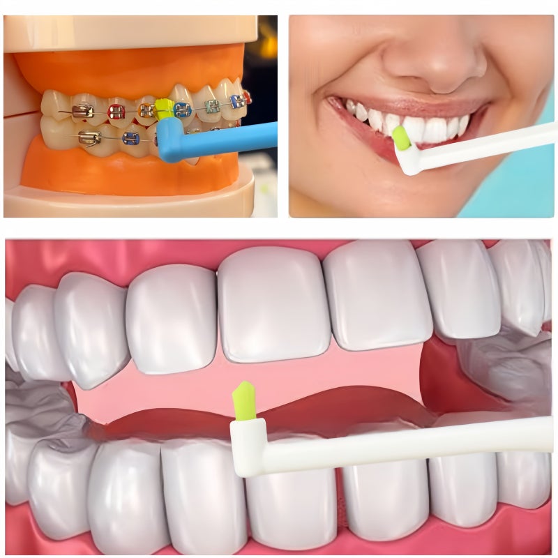 6 Pcs Tufted Toothbrush Set Blue White End Interdental Single for Ortho Braces Detail Cleaning - Image 4