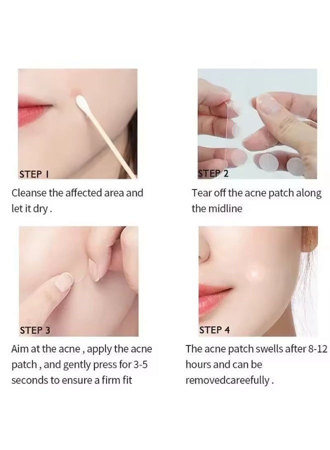 LANBENA  Acne Repair Patch Facial Care Device Fade Blemishes Pimple Marks Closed Acne Blemishes Cover Acne Pimple Repair Patch Tire - Image 4