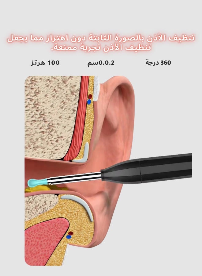 Dr.isla منظف الأذن الذكي Dr.isla P2 – جهاز واي فاي مزود بكاميرا دقيقة 500 واط لإزالة الشمع برؤية واضحة - Image 4