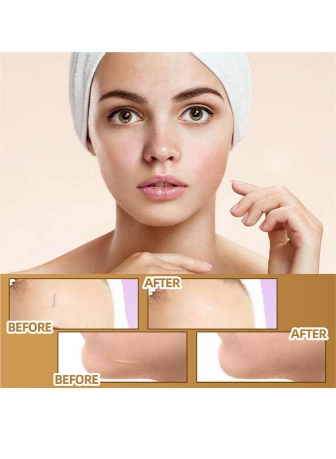 Jaysuing 120PCS  Invisible Skin Concealer Patches, Waterproof Tattoo Scar Cover Up Stickers, Breathable Durable Body Makeup For Bruises Stretch Marks Dark Spots Vitiligo - Image 4
