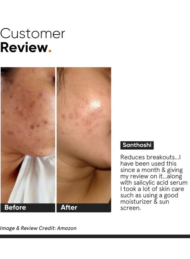 منيماليست 2 ٪ مصل حمض الساليسيليك للحد من الجلد الدهنية وحب الشباب والرؤوس السوداء | يساعد في المسام المفتوحة والخروج والملمس الوعر - Image 4