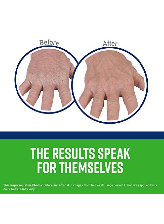 O'Keeffe's Working Hands Hand Cream 3 Ounce Tube And Eczema Relief Hand Cream 2 Ounce Tube - Image 4