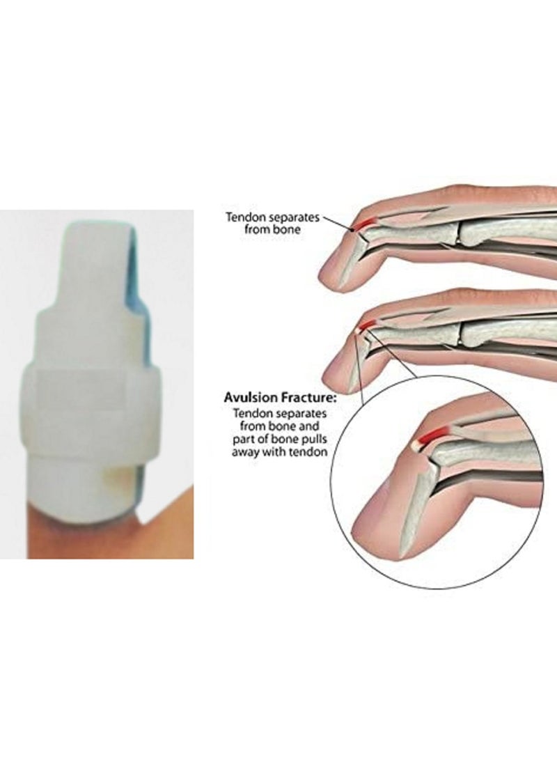 Plastic Finger Support Splint White