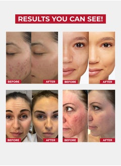 Face Fresh Gold Plus 4 in 1 Beauty Pack - Removes Acne, Dark Spots, Fine Lines, Wrinkles & Increases Skin Firmness - For All Skin Types  - Image 2