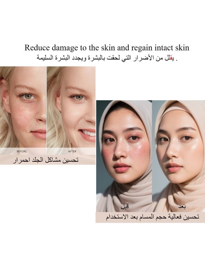 Wsstacxy Filtered Hand Shower for Hair Loss and Skin High Pressure Shower Head Filter Removes Chlorine and Harmful Pollutants Water Softener for Shower - Image 4