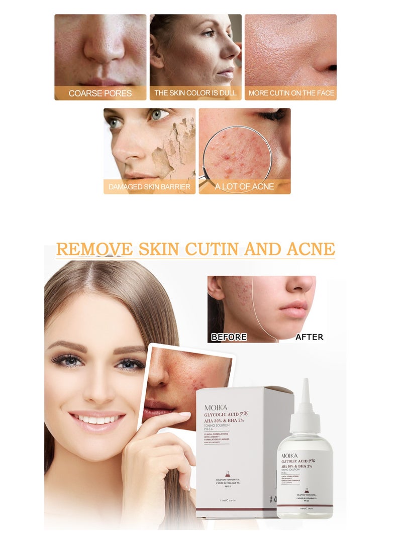 MOIKA Remove Acne, Fade Acne Marks, Repair Skin, Glycolic Acid 7% Toner 110ml - Image 4