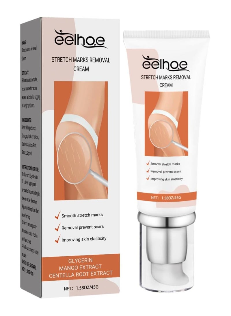 Eelhoe Stretch Mark Removal Cream Treatment Scars Acne Stretch Marks Remove Postpartum Anti Wrinkle Pregnancy Mark Remove Cream Anti Aging Wrinkles Repair Maternity Stretch Mark Scars Acne Smooth Skin Cream