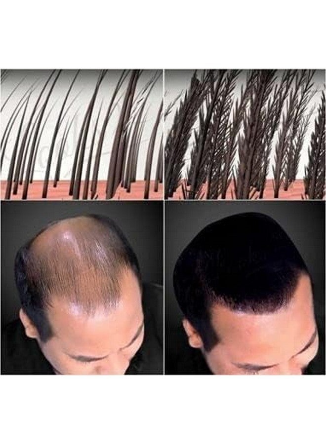 HyrgraceeÂ® Hair Building Fiber Absolutely Natural Refill Pack Use For Men Black (25 Gram) - Image 2