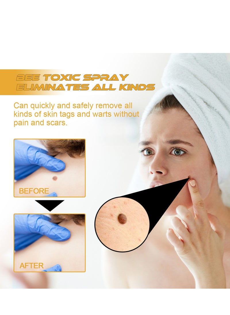 ximonth - Tag Recede Bee Venom Repair Spray, A Gentle Safe Portable Wart Removal Spray with Natural Extracts for All Skin Types，Universal for Both Men and Women Wart Removal .Protecting Health and Beauty. - Image 1