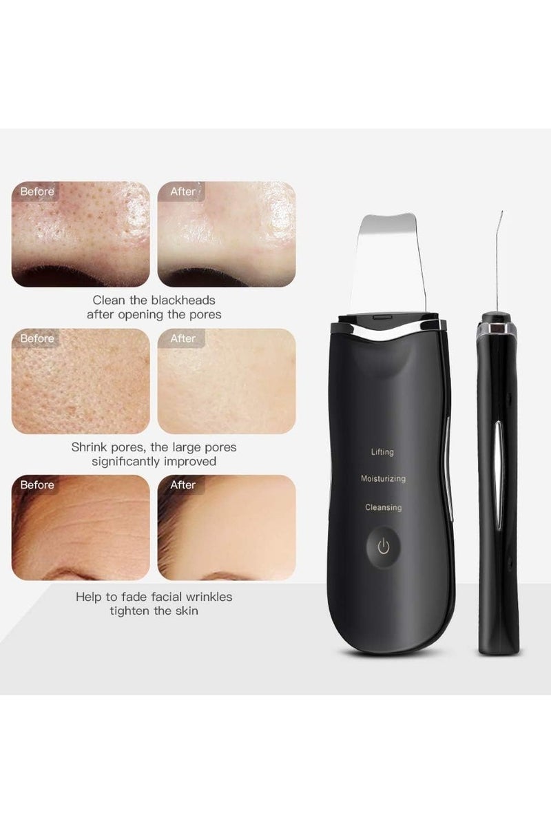 Face Spatula Deep Ion Cleansing Exfoliating Scraper Rechargeable Beauty Massager, Blackhead Remover Acne Peeling Lifting Care Skin Device Black - Image 4