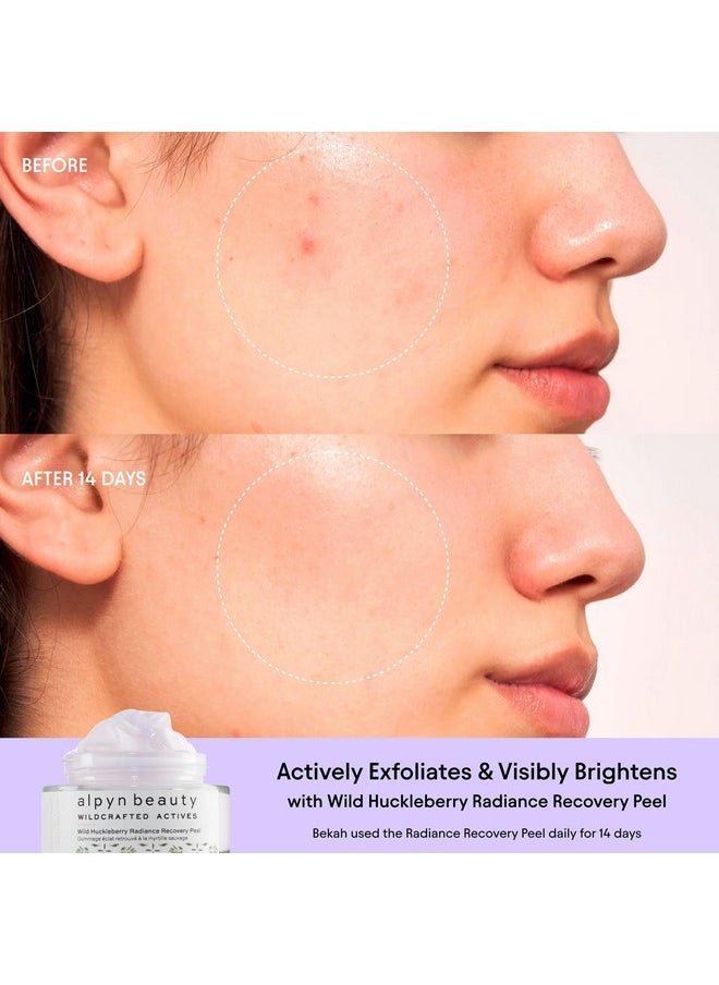 Alpyn Beauty - Alpyn Wild Huckleberry Recovery Peel Reduce Redness Actively Exfoliate Skin Moisturizer & Soothes 1.7 Oz / 50 Ml - Image 1