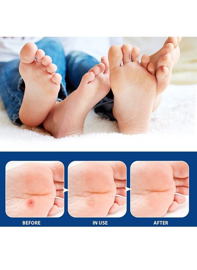 SOUTH MOON - 24 Pcs Foot Corn Removal Plaster,Natural Ingredients,Foot Care Expert,Calluses Plantar Treatment,Relief Pain From Calluses, Corns, Blisters, Heel Frictions - Image 1