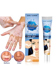 SOL LORA Vitiligo Ointment, Reduce White Spots and Improve Skin Pigmentation, Spotted Sweat Stained Vitiligo Skin Cleansing Ointment - 20G  - Image 2