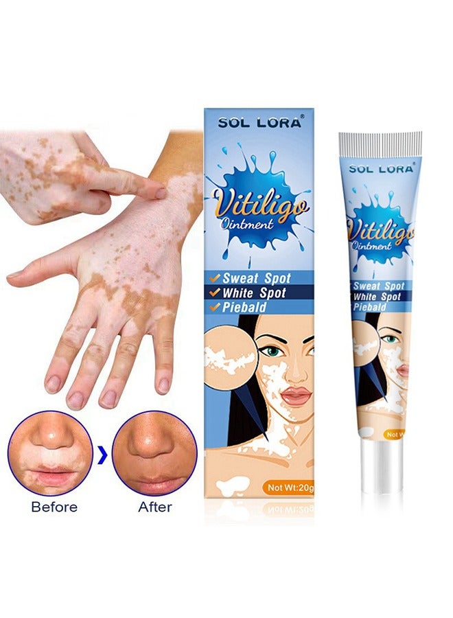 SOL LORA Vitiligo Ointment, Reduce White Spots and Improve Skin Pigmentation, Spotted Sweat Stained Vitiligo Skin Cleansing Ointment - 20G - Image 2