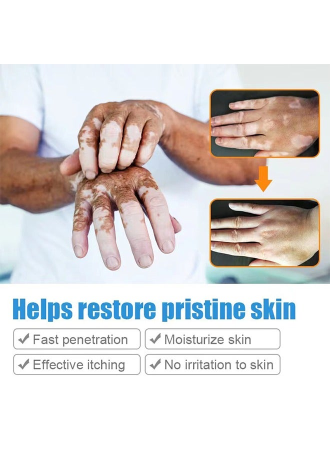 SOL LORA Vitiligo Ointment, Reduce White Spots and Improve Skin Pigmentation, Spotted Sweat Stained Vitiligo Skin Cleansing Ointment - 20G - Image 4