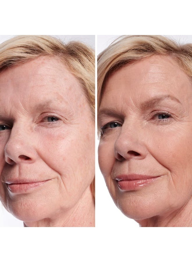 آي كوزمتيكس خافي عيوب البقع الداكنة من آي تي ​​كوزماتيكس - متوسط ​​كول 30 - Image 2