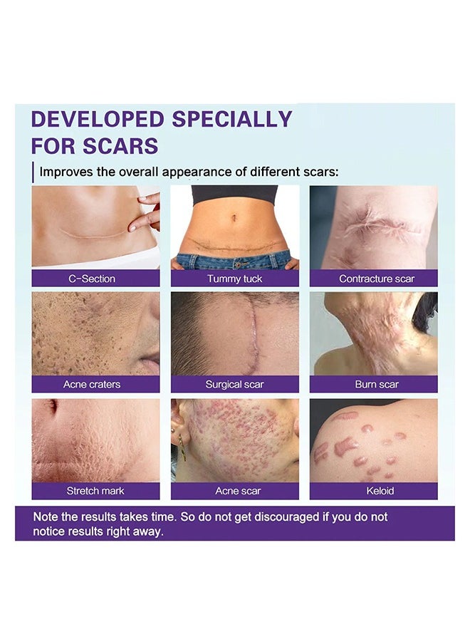 West&Month High-Quality Silicone Scar Gel- Professional Scar Removal Cream for Surgical Scars, Stretch Mark, Keloid Bump, C-Section, Burn, Old and New Scars (20g)  - Image 2