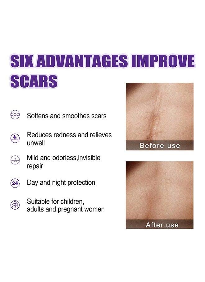 West&Month High-Quality Silicone Scar Gel- Professional Scar Removal Cream for Surgical Scars, Stretch Mark, Keloid Bump, C-Section, Burn, Old and New Scars (20g)  - Image 4