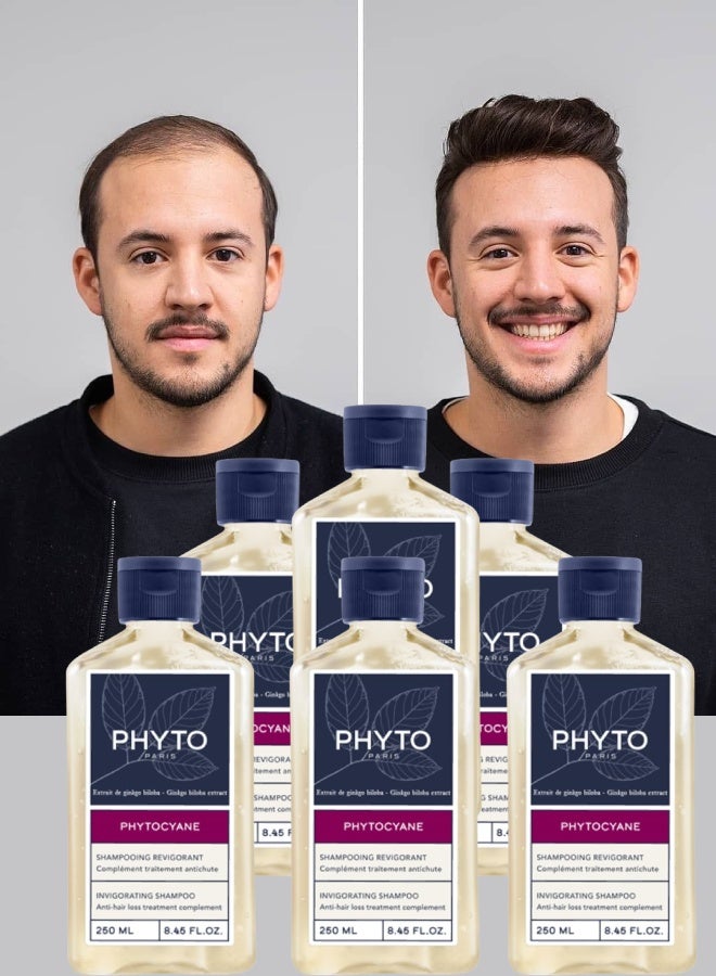 فيتو 6 قطع شامبو فيتو باريس لعلاج تساقط الشعر للنساء و الرجال منشط 250مل - Image 1