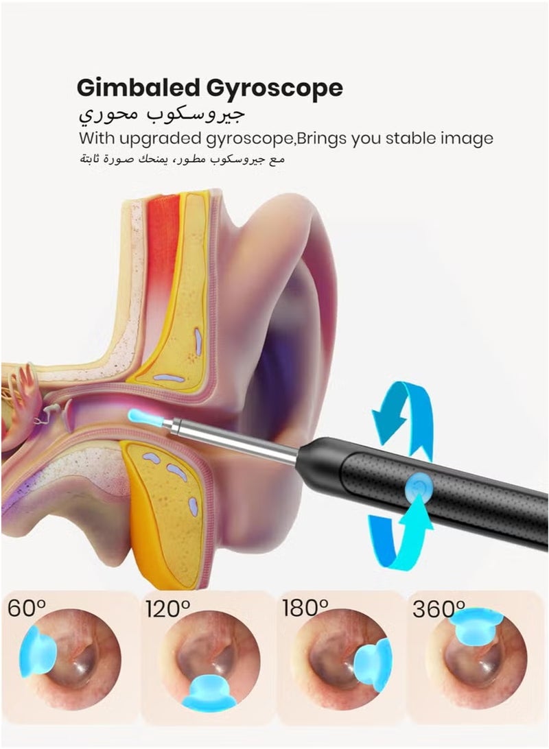 يلا جوي إزالة شمع الأذن - كاميرا 2000 واط HD مع أداة إزالة شمع الأذن الكاميرا مع مجموعة 9 أجهزة كمبيوتر شخصية - مجموعة إزالة شمع الأذن مع ضوء - مع 6 ملعقات أذن سيليكون ناعمة - منظف الأذن لـ iOS و Android - Image 5