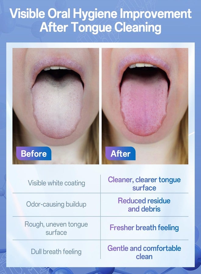 BodyAccel Silicone Tongue Cleaner for Adults, Soft & Gentle Tongue Brush and Scraper, Helps Remove Bad Breath, Flexible Non-Slip Handle for Comfortable Control - Image 4