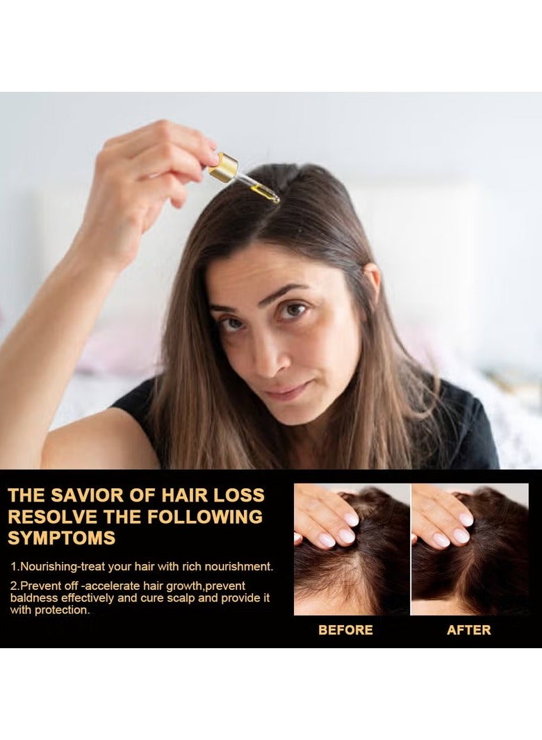 Sumifun Hair Repair Lotion, Hair Oil, Hair Loss Treatment, Moisturizing Anti Loss Hair Growth Essence, Promote Healthy Hair, Strengthen Hair Growth 30ml - Image 4