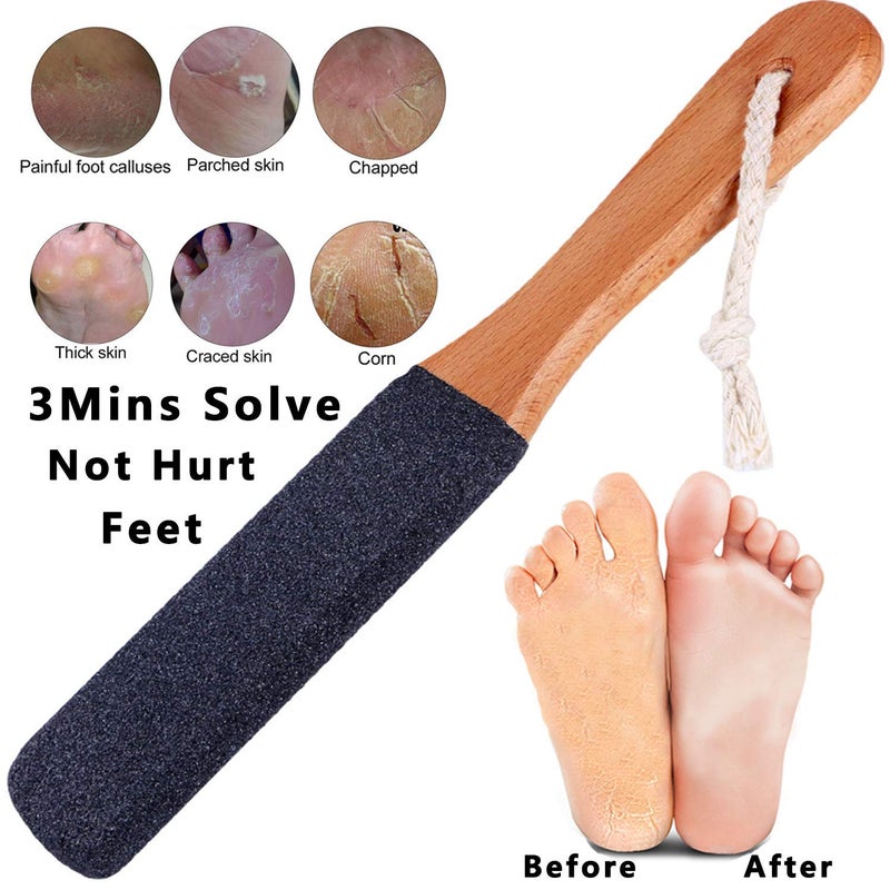 Kinepi Foot File Callus Remover Foot Scrubber,Professional Pedicure Foot Rasp Removes Cracked Heels,Dead Skin,Corn,Hard Skin,Pumice Stone for Scraper File Brush Tools for Wet and Dry Feet - Image 2
