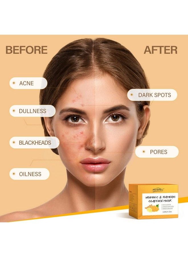 POP MODERN.C - Turmeric Vitamin C Clay Mask Deep Cleansing Face Mask Skin Care Improve Blackheads Acne Dark Spots And Even Out Skin Tone Facial Mask Control Oil And Refining Pores - Image 1