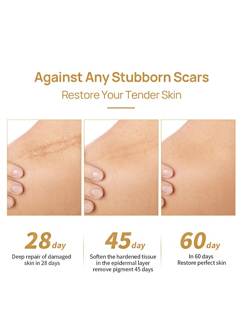 LANBENA - Herbal repair scar cream 30g, scar gel, skin repair gel, natural plant ingredients, effectively repair old and new scars, burns, stretch marks, acne, sunburn (30g) - Image 1
