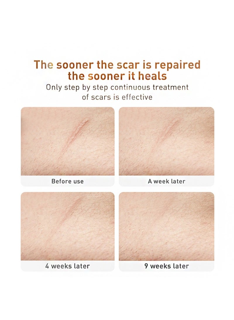 LANBENA - Herbal repair scar cream 30g, scar gel, skin repair gel, natural plant ingredients, effectively repair old and new scars, burns, stretch marks, acne, sunburn (30g) - Image 1