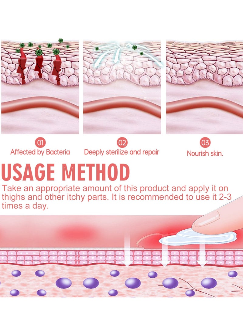 ساوث مون مرهم الأكزيما الخاص لتخفيف الحكة ، وإزالة الرائحة ، والإغاثة الموضعية - Image 5
