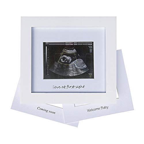 IHEIPYE Baby Sonogram Photo Frame - Ultrasound Picture Frame for Expecting Parents, Baby Showers, Gender Reveal Parties, Nursery Decor (Silver Text, White) - Image 1