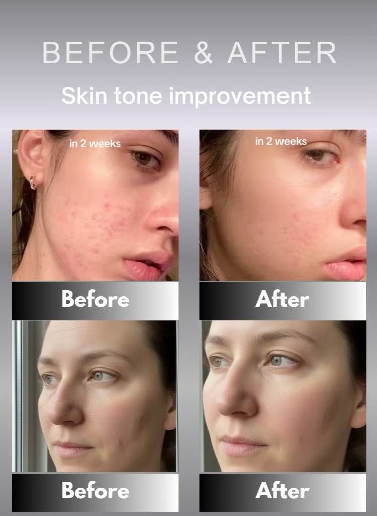 سيليماكس بور+ للعناية بتفتيح البقع الداكنة وواقي الشمس 50 مل - Image 4