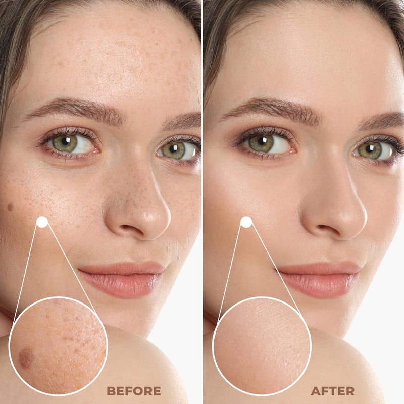 Profusion Cosmetics Lightweight Liquid Foundation for a Flawless and Elegant Radiance, Breathable Makeup that Improves Uneven Skin Tone, Vegan & Cruelty-Free - Fair 3 - Image 4