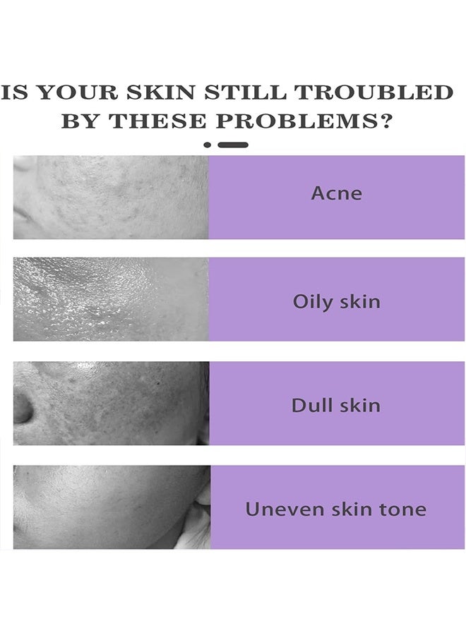 West&Month 15% Azelaic Acid, Niacinamide & Vitamin C,Reduce Face Acne and Repair Skin Discoloration,Hydrating Facial Cream for Acne-Prone & Blemish-Prone Skin, Redness Calming Azelaic Acid Gel for Smooth Skin Texture,20g - Image 3