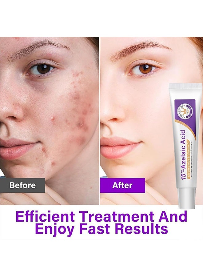 West&Month 15% Azelaic Acid, Niacinamide & Vitamin C,Reduce Face Acne and Repair Skin Discoloration,Hydrating Facial Cream for Acne-Prone & Blemish-Prone Skin, Redness Calming Azelaic Acid Gel for Smooth Skin Texture,20g - Image 4