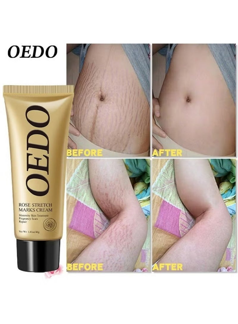 OEDO 2pcs Rose Stretchmarks Cream 40g Maternity Skin Treatment Pregnancy Scars Repair, Can Promote Cell Regeneration, Repair Necrotic Cells and Enhance Skin Elasticity, Designed For Mother's Stretch Marks - Image 2
