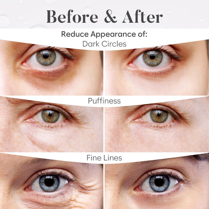 BLOOMORA Variety Under Eye Patches (30 Pairs) - Dark Circles & Puffy Eyes Care - Eye Care Mask for Refreshment - 5 Varieties - Image 4