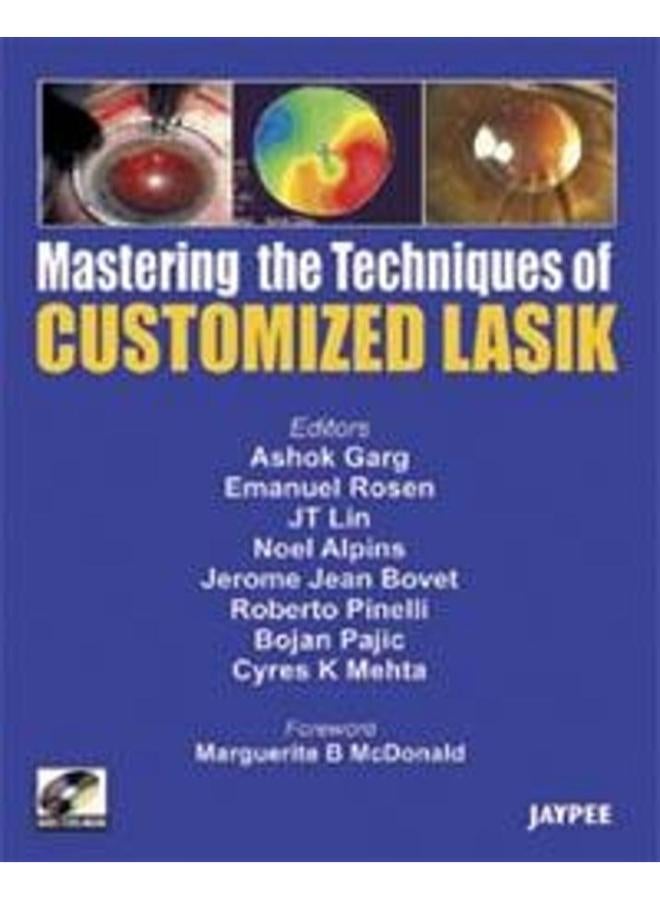 Mastering the Technique of Customized Lasik 