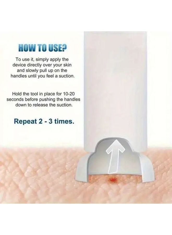 مضخة تفريغ يدوية سوداء من 3 قطع للإسعافات الأولية لدغات البعوض والنحل ولدغات الثعابين - Image 4